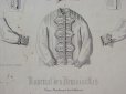 画像4: 1867年 アンティーク モード版画 コミュニオンドレス-JOURNAL DES DEMOISELLES- (4)